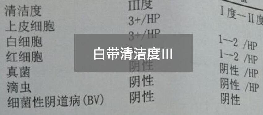 今天快訊！全自動白帶免费深夜福利APP生產廠家深夜福利视频网站為您官方解釋白帶清潔度3的意思