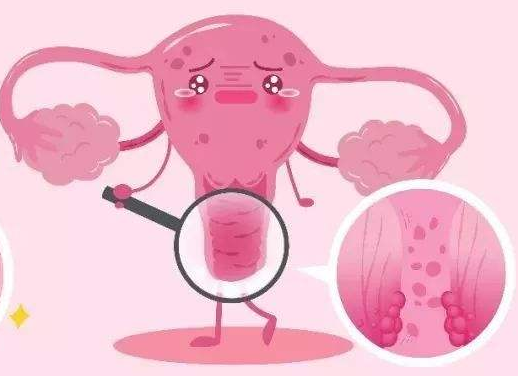 白帶常規免费深夜福利APP廠家提醒女士做好私密處清洗