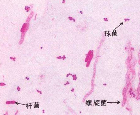 婦科白帶深夜福利影院廠家分析白帶線索細胞陽性的意義