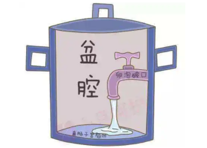 盆腔積液是怎麽回事？白帶免费深夜福利APP廠家提醒早了解早預防